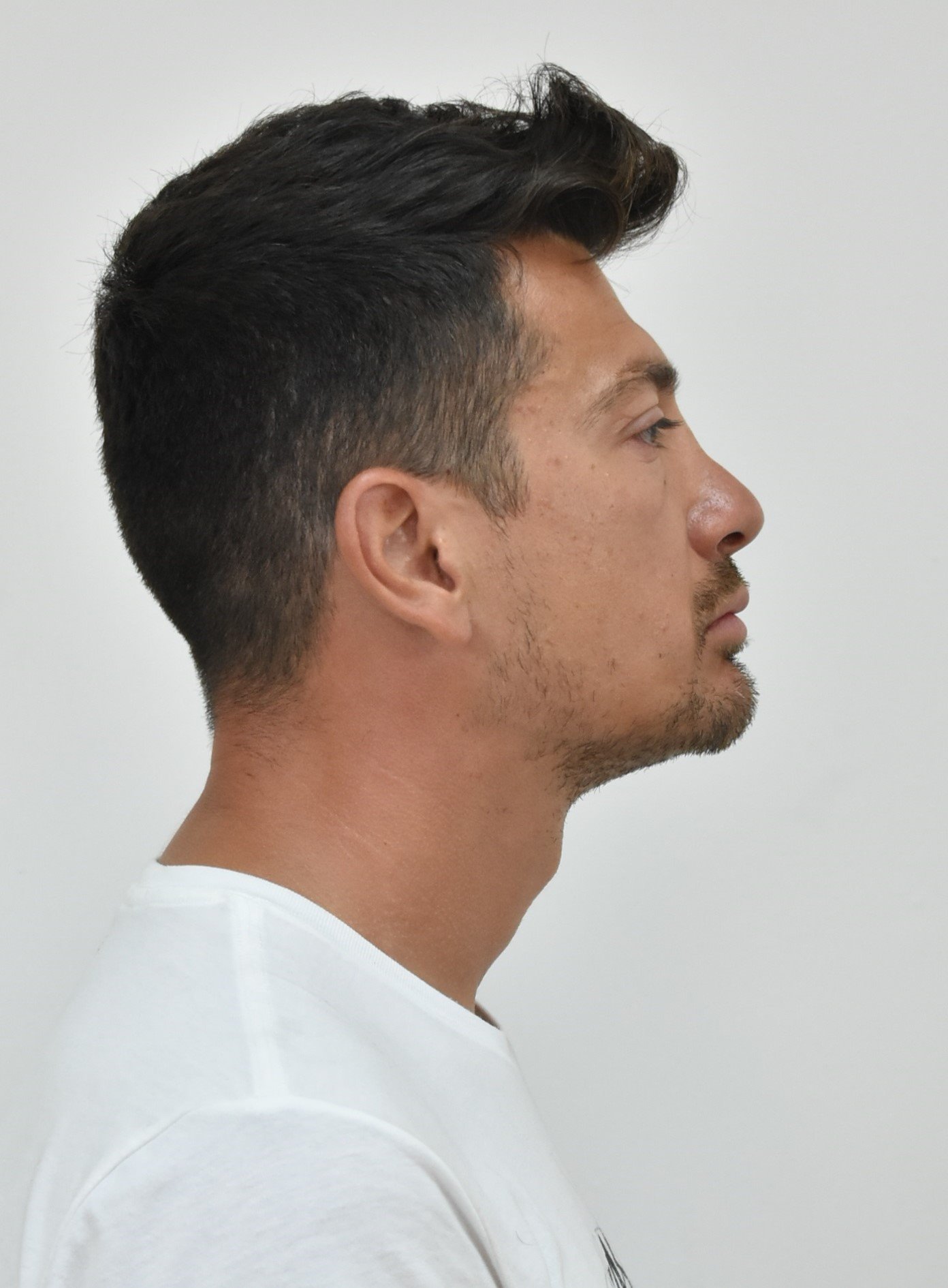 proponitis-tenis.jpg proponitis-tenis.jpg