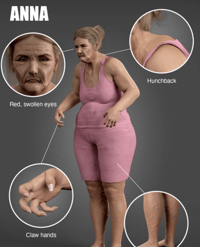 anna.jpg Άννα