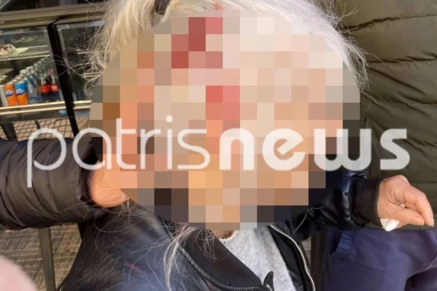 70xroni-listeia.jpg 70χρονη χτύπησε στο κεφάλι μετά από ληστεία