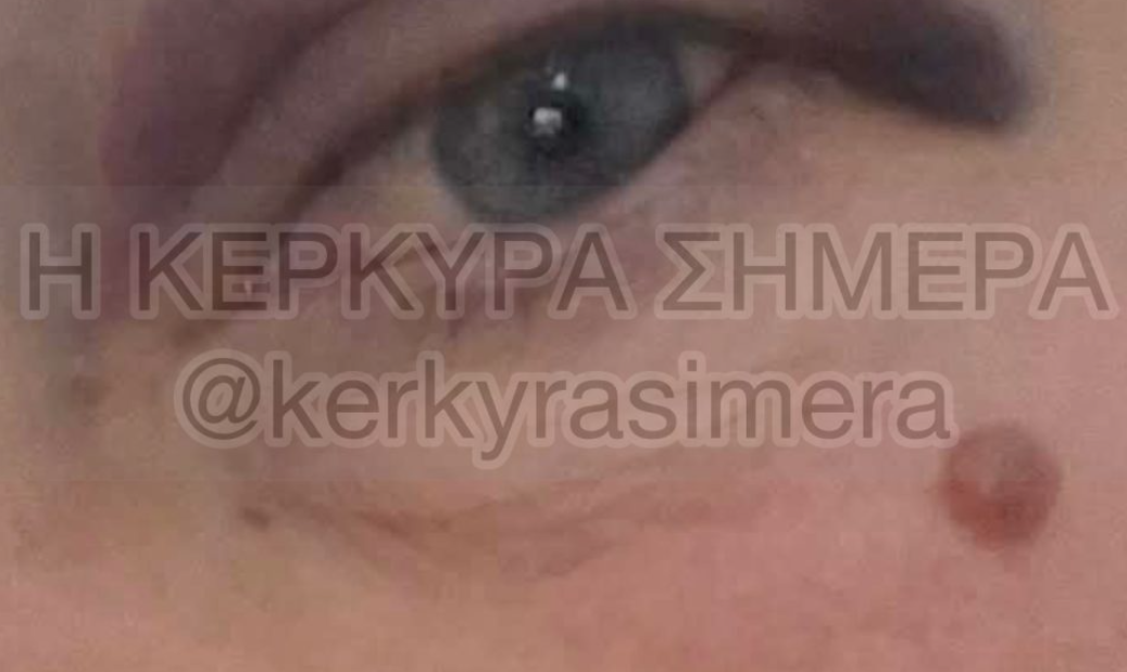 τραυματισμένη εκπαιδευτικός