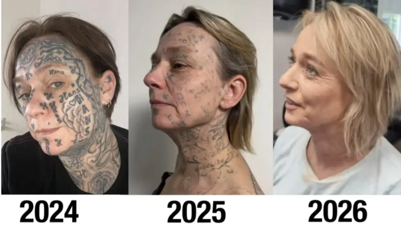 Φρίκη στην Ολλανδία: Άνδρας χάραξε το όνομά του 250 φορές στο σώμα της συντρόφου του