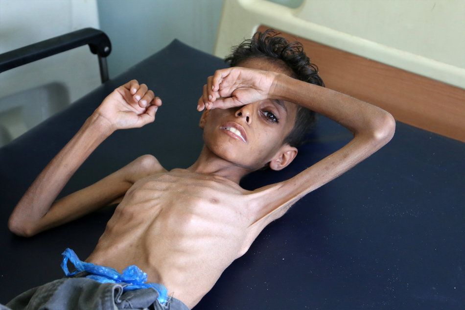 yemenh1.jpg Εμφύλιος στην Υεμένη