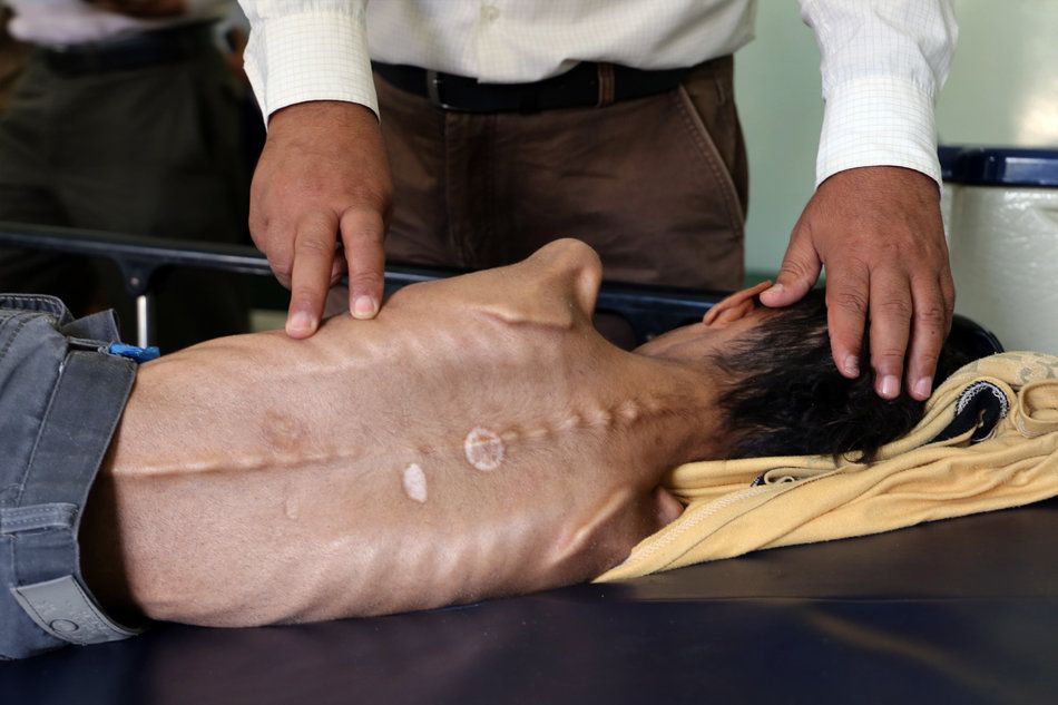 yemenh2.jpg Εμφύλιος στην Υεμένη
