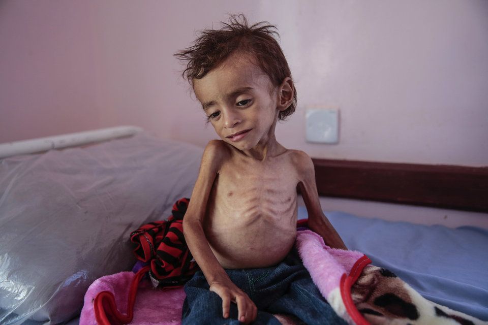 yemenh4.jpg Εμφύλιος στην Υεμένη