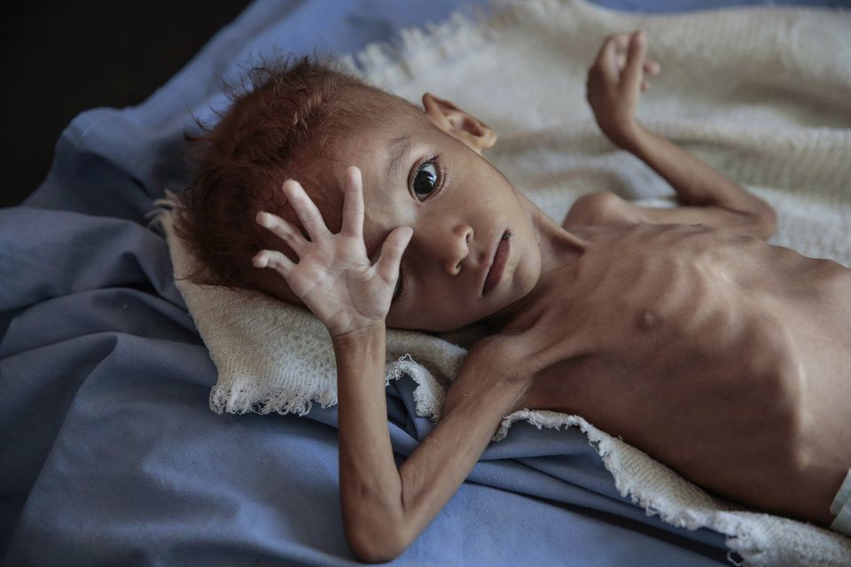 yemenh5.jpg Εμφύλιος στην Υεμένη
