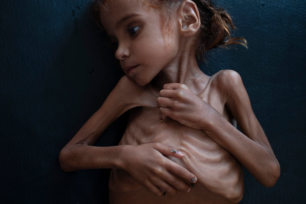 yemeni.jpg Ασλάμ, Υεμένη
