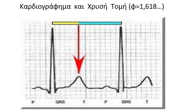 kardiografima.jpg kardiografima.jpg
