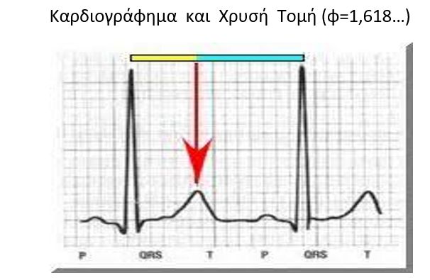 kardiografima.jpg