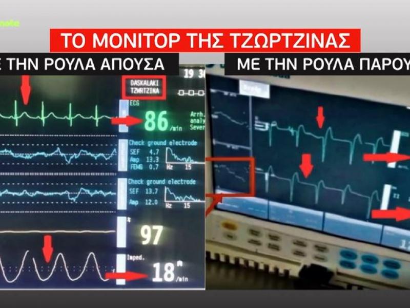 Πάτρα: Νέο ντοκουμέντο από το μόνιτορ της Τζωρτζίνας