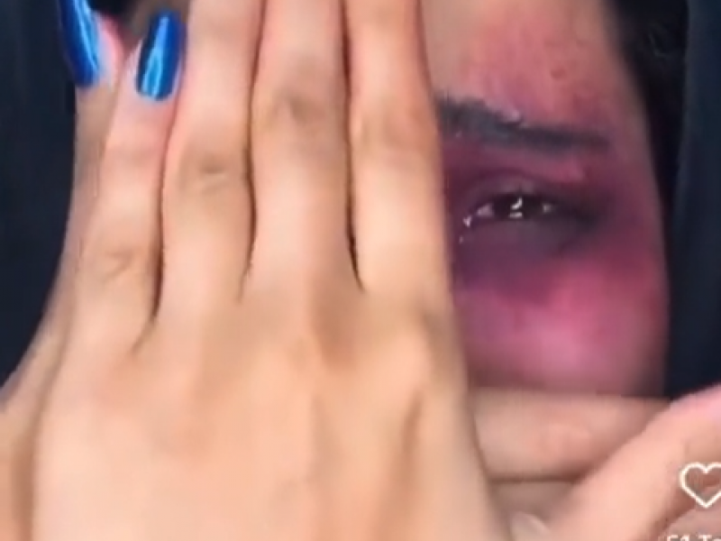 Βίντεο σοκ: Σκληρές εικόνες από την κακοποίηση των γυναικών στο Ιράν