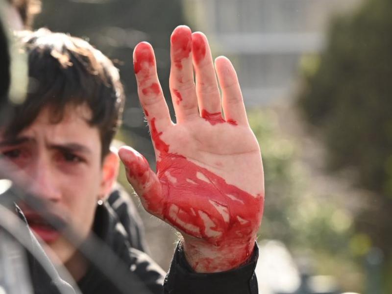 Άγρια επίθεση των ΜΑΤ: Σοκαριστικές φωτογραφίες με τους τραυματίες φοιτητές - Άνοιξαν κεφάλια