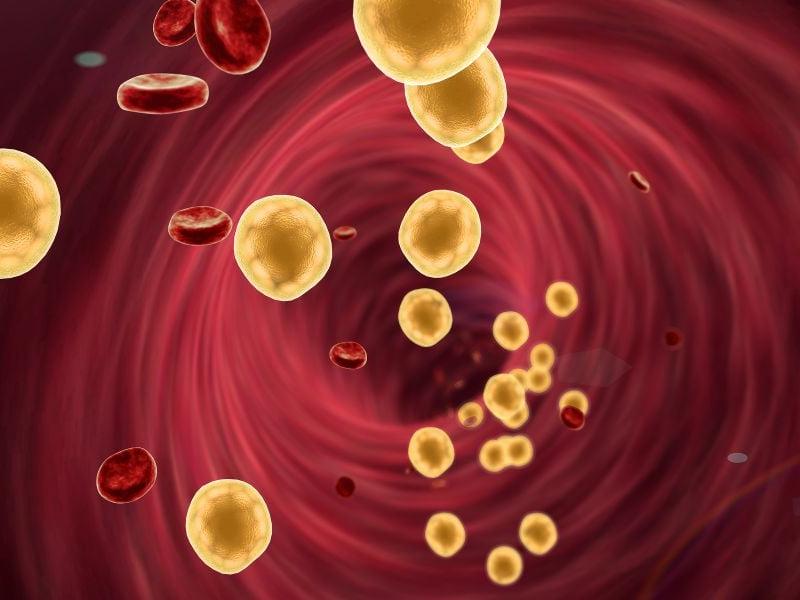cholesterol