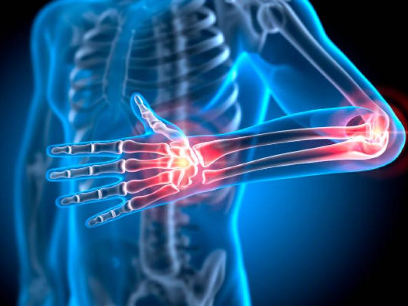 arthrwseis