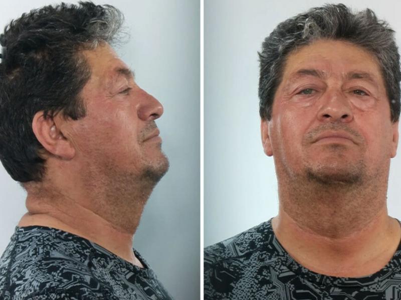 Βιασμός μαθήτριας στο Ηράκλειο: Αυτός είναι ο γυμνασιάρχης που προφυλακίστηκε (Φωτογραφίες)