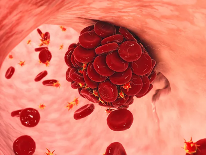 thrombos