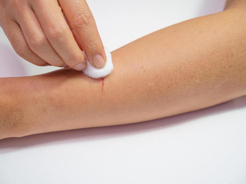 γρατζουνια