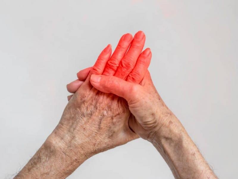 ρευματοειδης