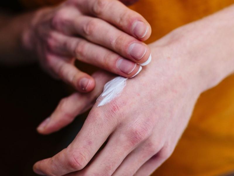 Συναγερμός: Ανακαλείται πασίγνωστο αντηλιακό - Κίνδυνος για εγκαύματα