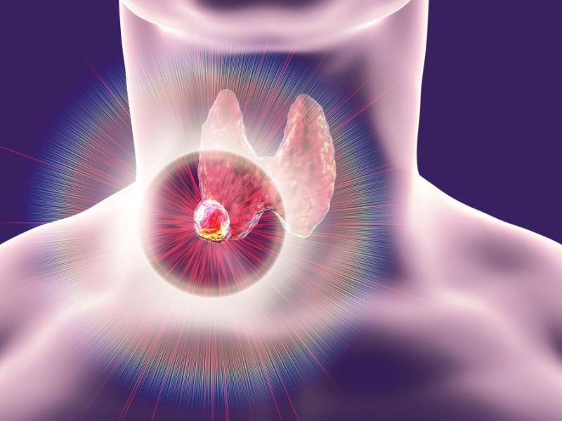 Καρκίνος θυρεοειδούς