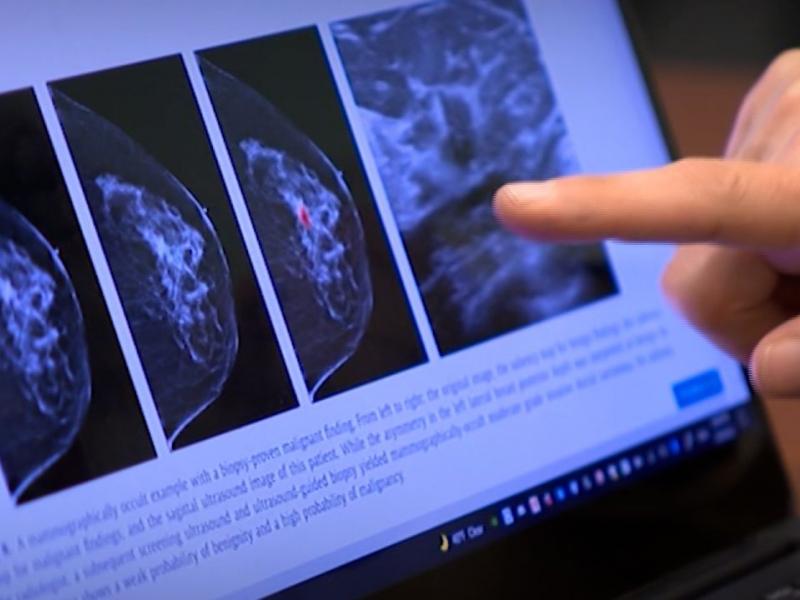 Η τεχνητή νοημοσύνη θα ακούει τις ομιλίες ανθρώπων και θα κάνει διάγνωση για καρκίνο