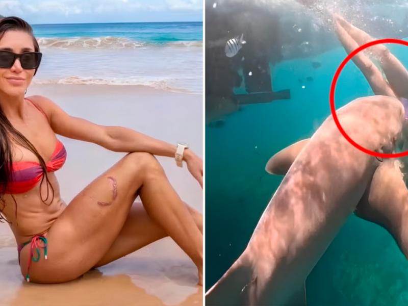 Βουτιά τρόμου: Καρχαρίας δαγκώνει πόδι γυναίκας (Video)