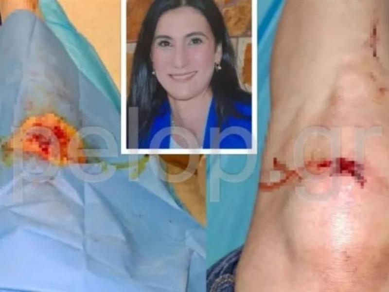 Ένα σοκαριστικό περιστατικό με θύμα μια μητέρα τριών παιδιών σημειώθηκε στην Πάτρα και συγκεκριμένα στα σύνορα ανάμεσα σε Νέο Σούλι και Ριγανόκαμπο.