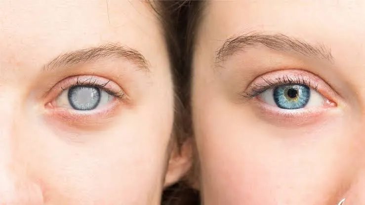 eyes