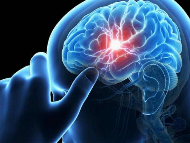 Εγκεφαλικό: Τι μπορεί να πετύχει ο βελονισμός