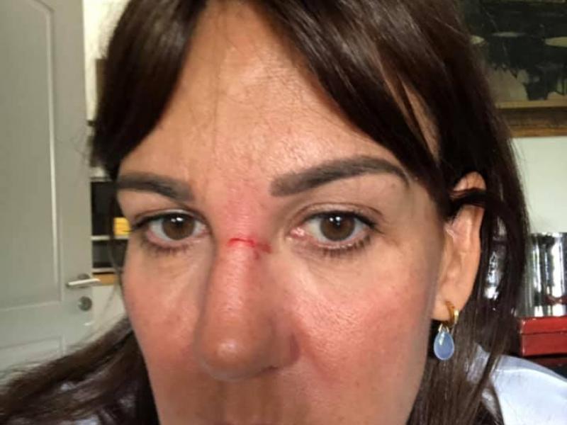 "Είναι η 2η φορά σε δύο μόλις ημέρες που ο Γιάννης με χτυπάει"