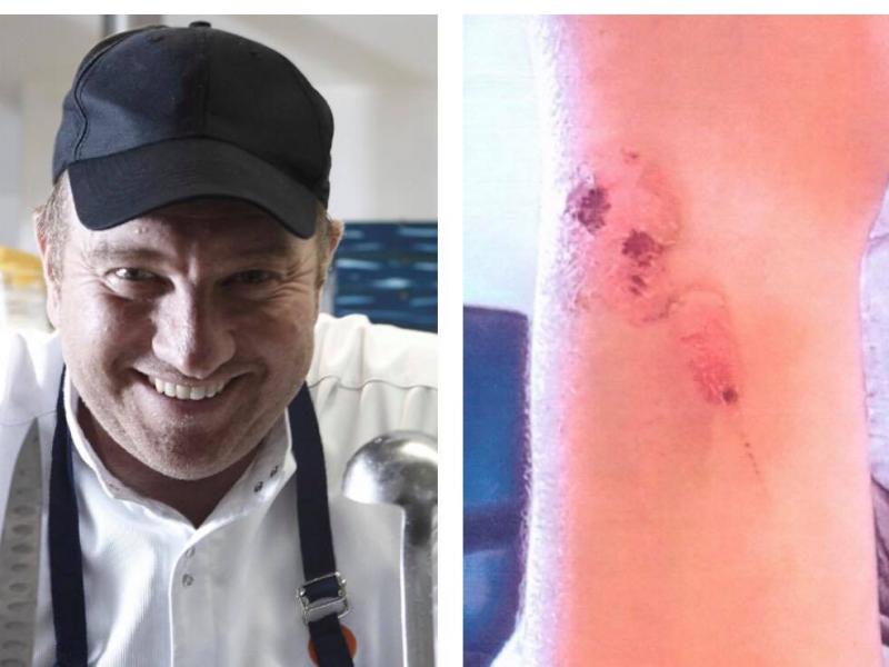 Κέρκυρα: Απομακρύνθηκαν υπάλληλοι από το εστιατόριο του Μποτρίνι