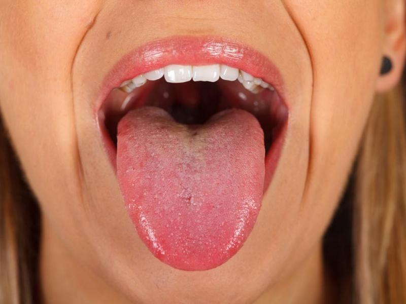 ΕΚΠΑ: Ελπίδες για γρηγορότερη πρόγνωση των μεταστάσεων του καρκίνου του στόματος