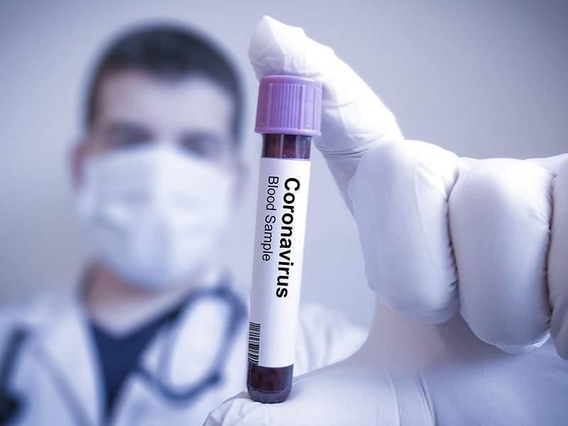 ΕΚΠΑ: Δύσκολη και χρονοβόρα η μαζική παρασκευή του φαρμάκου remdesivir αν εγκριθεί για θεραπεία του κορονοϊού