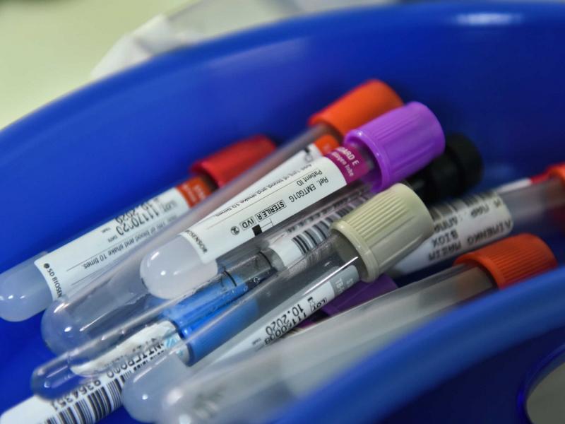 Εντατικά τεστ για κορονοϊό σε Ξάνθη
