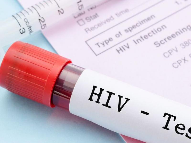 Παγκόσμια Ημέρα κατά του AIDS: Δωρεάν τεστ από τον ΕΟΔΥ στην πλατεία Κοραή