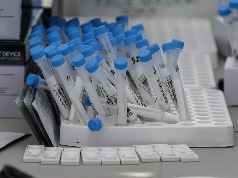 Φθηνότερα από σήμερα rapid test και μοριακά pcr (εγκύκλιος)