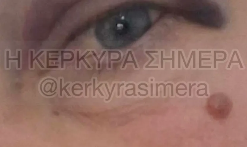 τραυματισμένη εκπαιδευτικός