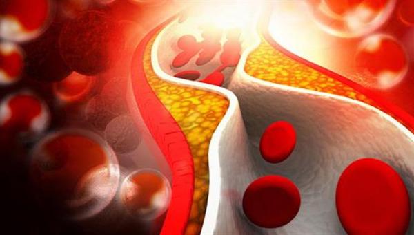 Χοληστερόλη