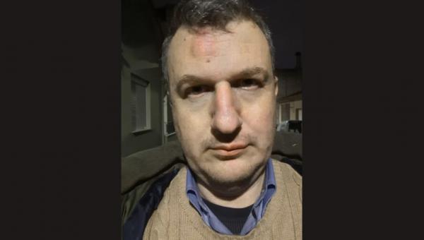 Άγριος ξυλοδαρμός του εκδότη της εφημερίδας «Μαγνησία» στον Βόλο – «Δεν μας πτοούν οι τραμπουκισμοί»