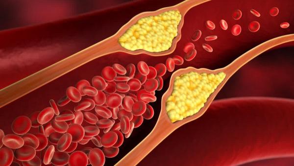 χολιστερινη