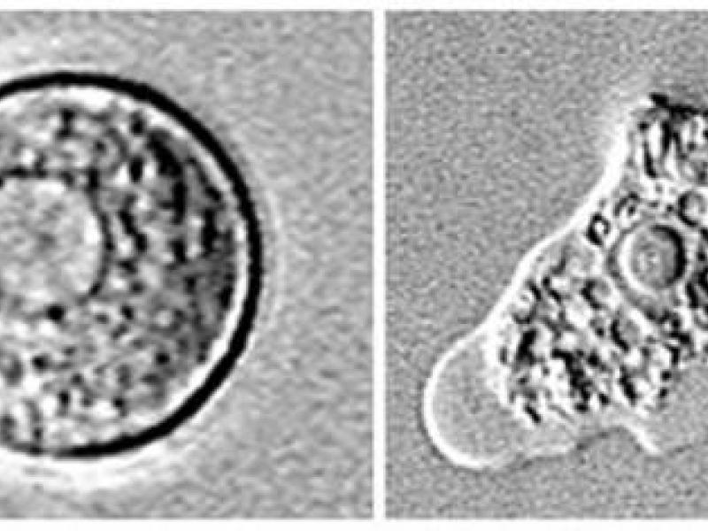 130729155831-naegleria-fowleri-amoeba-story-top-thumb-medium.jpg