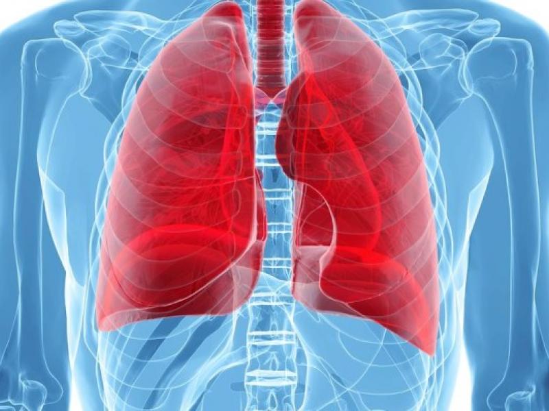 17115pneumonikiemboli-666x399.jpg
