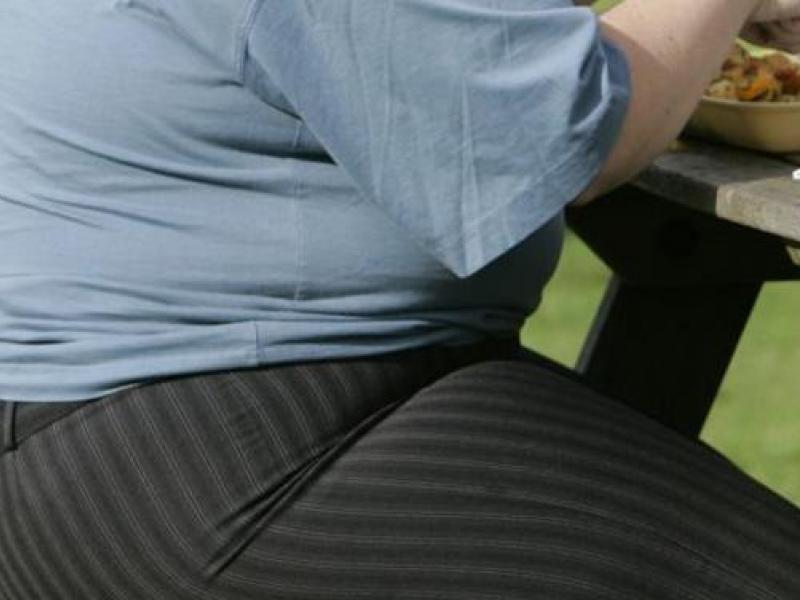 20054592_global_obesity_jpeg_08f66.limghandler.jpg
