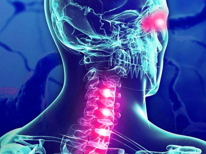 Σκλήρυνση κατά πλάκας