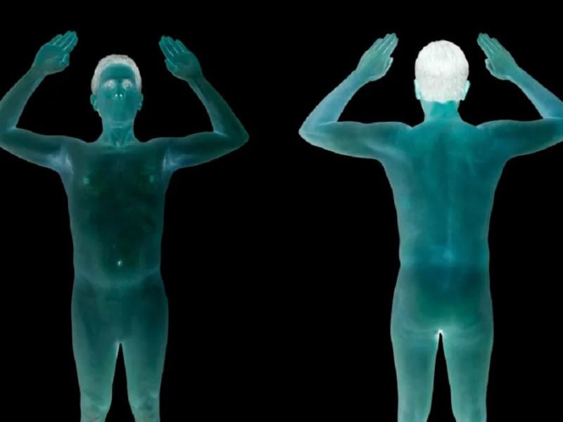 Απεικονίσεις - ακτινογραφίες