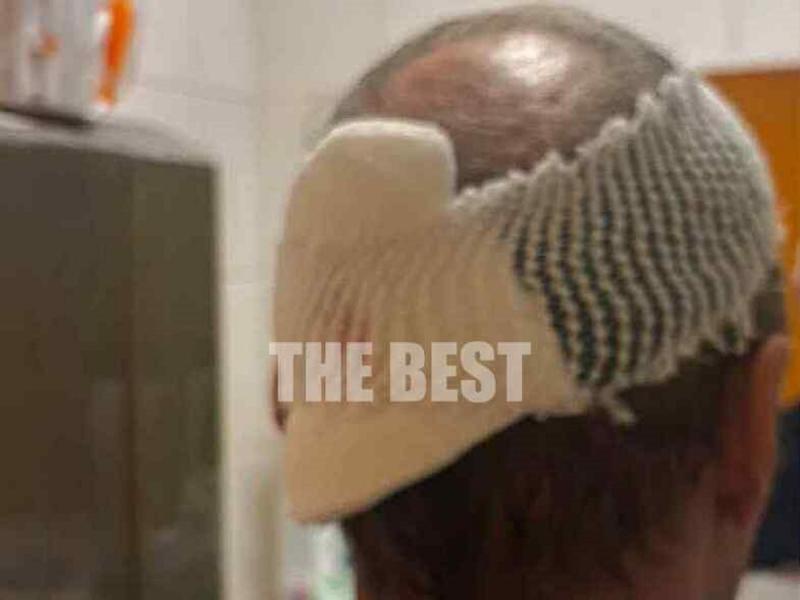 Πάτρα: Έκανε βόλτα στην παραλία με τη γυναίκα και τον ανήλικο γιο του και κατέληξε στο νοσοκομείο- Έπεσε πάνω του ένας… σκύλος