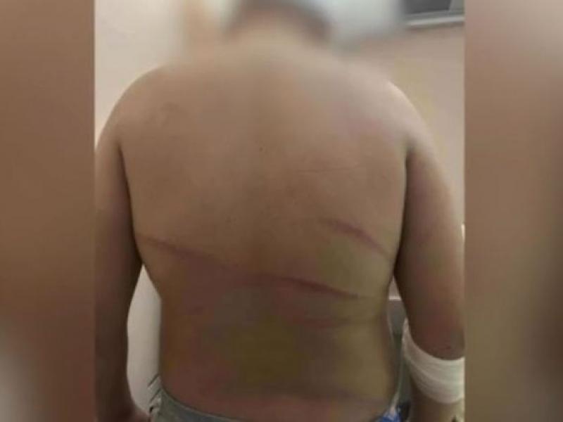 13χρονος ξυλοδαρμός