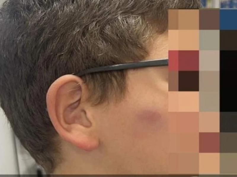 Ξυλοκόπησαν 11χρονο μαθητή στο προαύλιο του σχολείου τους