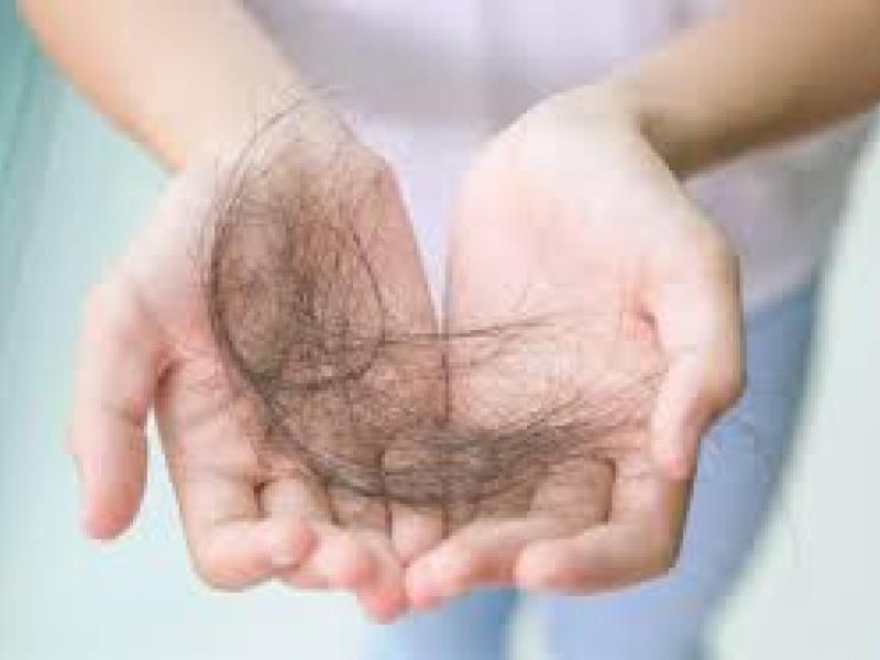 τριχοπτωση