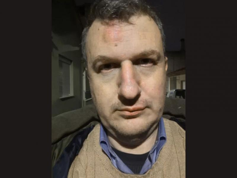 Άγριος ξυλοδαρμός του εκδότη της εφημερίδας «Μαγνησία» στον Βόλο – «Δεν μας πτοούν οι τραμπουκισμοί»