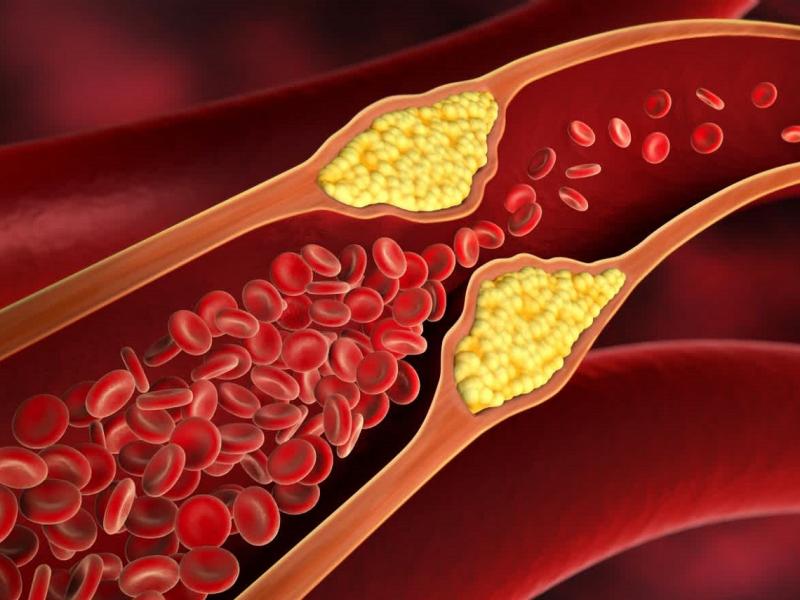 χολιστερινη